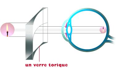 astigmate2