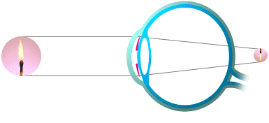 hypermetrope1