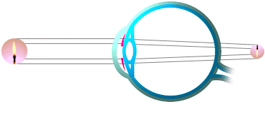 presbytie1