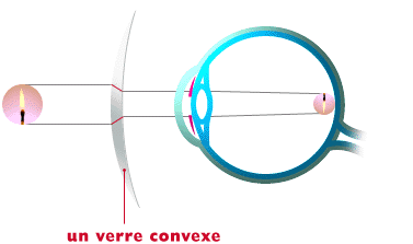 presbytie2